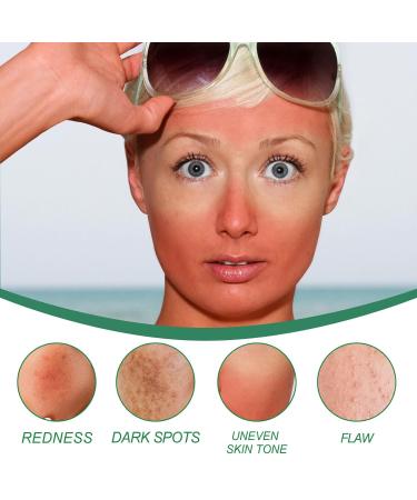 Color Correcting Cream - Hydrating Redness Treatment & After-Sun Care - Soothing Facial Cream for Spot Lightening (100g - Buy Online on GoSupps.com