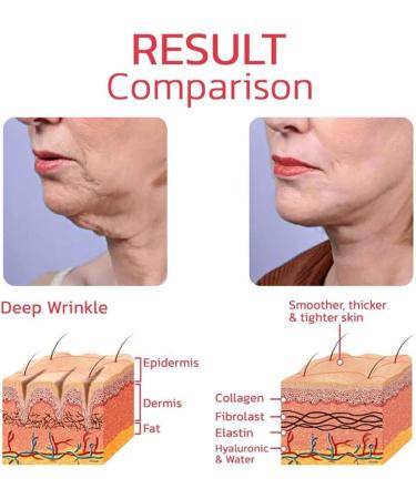 HOUXIANDOU Dragon Blood Cream Essence Lady Face Cream Dragons Blood Easy Cream Firm AntiWrinkle Cream for Women Reduce Fine Lines Moisturize Skin 1 Bottle - Buy Online on GoSupps.com