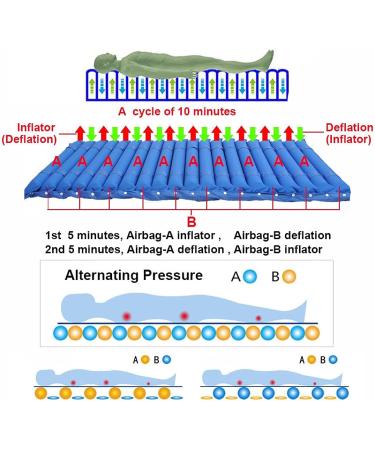FooJo Exchange Pressure Mattress Air Bed - Wound Care & Pressure Ulcer Relief | Pneumatic Massage Pillow for Bedridden Comfort - Buy Online on GoSupps.com