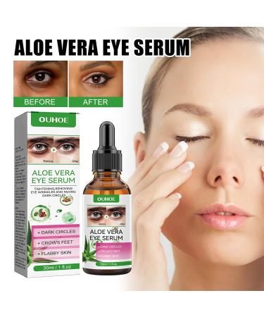 Eye Serum for Dark Circles & Bags | Hyaluronic Acid Anti-Aging Eye Cream for Men & Women (2PC) - Buy Online on GoSupps.com