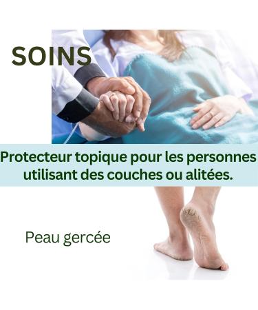 KEFUS Cr me Calamine Dexpanth nol avec Allanto ne et Vitamine E - Anti-D mangeaisons Piq res Moustiques & Anti-Frottements Sport - Astringente pr vient et soulage les irritations cutan es. 75 g. - Buy Online on GoSupps.com
