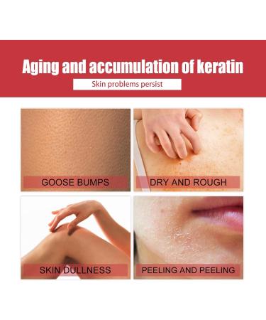 Anti Redness Face Serum for Women Fruit acid Face Serum for Blackhead & Large Pore Nourishing Dry Skin & Improve Skin Problems - Buy Online on GoSupps.com