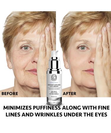 Buy Instant Ageless Eye Cream - Reduce Puffiness Tighten Skin & Smooth Fine Lines Fast | International Shipping - Buy Online on GoSupps.com