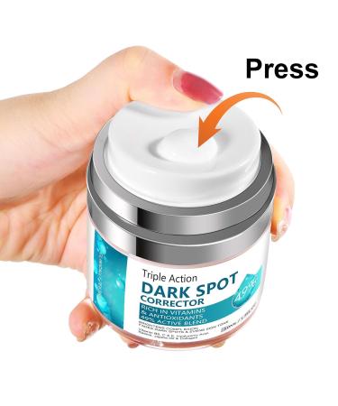 Dark Spot Remover Cream for Face & Body | Blemish Corrector for Age Spots Melasma Freckles & Sun Spots - Effective Dark Spot Treatment for Men & Women - Buy Online on GoSupps.com