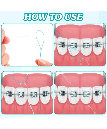 1000 Pcs Dental Floss Threaders for Braces and Implants | Multifunctional Nylon Loop Design | Pack of 20 (Blue) - Best for Oral Care - Buy Online on GoSupps.com