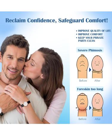 Lot de 2 Gels Correcteurs de Phimosis pour R tr cissement du Pr puce Gel Correcteur pour L'exc s de Pr puce Ingr dients Naturels Gel de Correction du Phimosis du Pr puce Soulagement Rapide - Buy Online on GoSupps.com