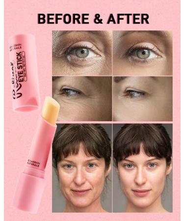 Retinol Under Eye Stick - Reduce Puffiness Dark Circles & Fine Lines | Eye Cream for Bags & Wrinkles - Perfect for Late Nights & Makeup Prep - Buy Online on GoSupps.com