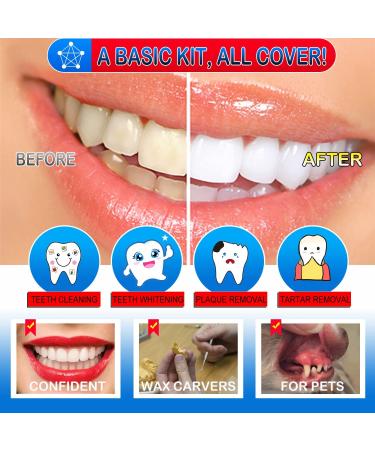 Dental Tools 10 Pack Professional Plaque Remover Set with Case - Stainless Steel Oral Care Kit for Teeth Cleaning, Tartar Scraper, Tooth Scaler, Tongue Cleaner - Black - Buy Online on GoSupps.com