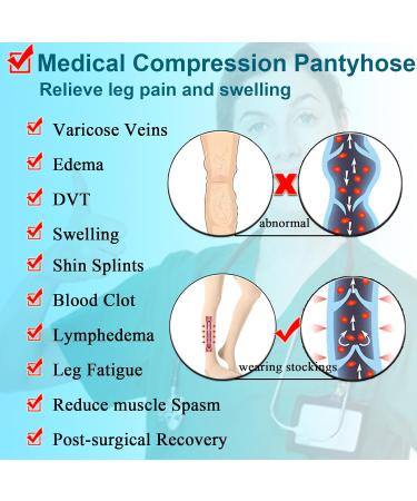 Buy Medical Compression Pantyhose 20-30mmHg for Men & Women - Varicose Veins Swelling Relief | Opaque Closed Toe Stockings - 4X-Large Size - Buy Online on GoSupps.com