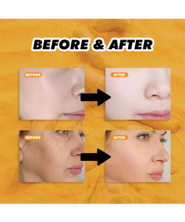 Eazerom Face Cream Turmeric Honey Face Cream 50 g - Buy Online on GoSupps.com