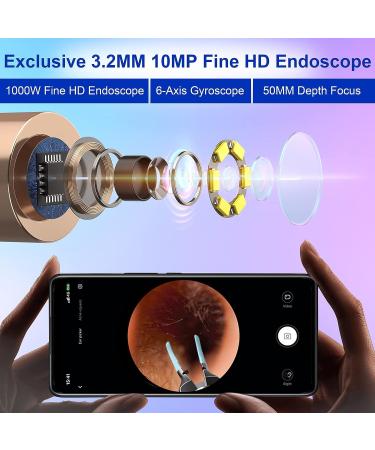 Bebird Pro Note5 Ear Wax Removal Tool Camera - 10MP HD Otoscope with Light & Tweezers - Spade Ear Cleaner for iPhone & Android - Blue - Buy Online on GoSupps.com