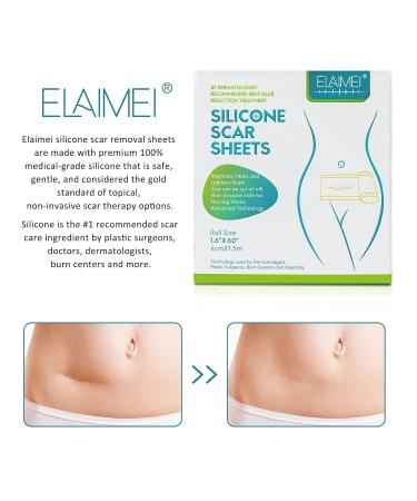 Medical Silicone Gel Tape for Scar Removal - Hypertrophic & Keloid Scars - Pain-Free & Water-proof - 1.6 x 60 - Buy Online on GoSupps.com