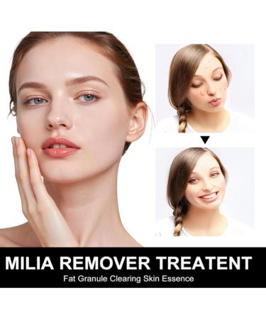 S rum de traitement Milia Remover traitement des taches pour une peau claire s rum contre l'acn pour les yeux et le visage facile porter (2pcs) - Buy Online on GoSupps.com