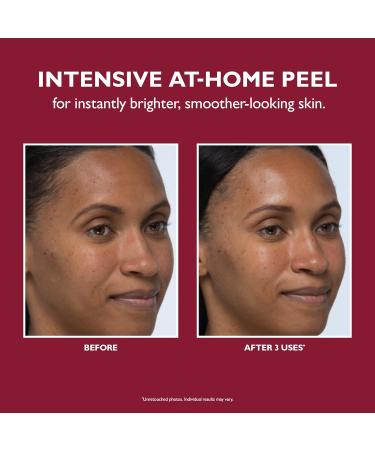 Peter Thomas Roth Even Smoother Instant Reveal Facial Peel - Revitalize Your Skin | Shop Internationally Now - Buy Online on GoSupps.com