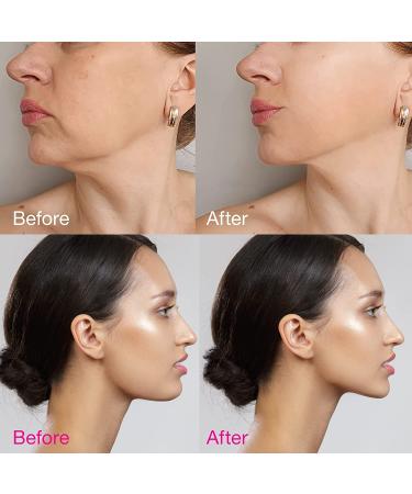 Galeboy V Line Lifting Mask: Double Chin Reducer & Eliminator for Women & Men (66cm) - Buy Online on GoSupps.com