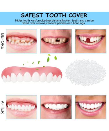 WGTczy Couples False Teeth Kit - Perfect Fit Pebble Gel Stickers for Missing Teeth | Restore Your Smile & Confidence - Buy Online on GoSupps.com