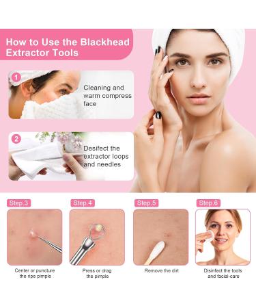 Fangze Blackhead Remover Tool Kit - 6 Pcs Pimple Popper Tool Kit Set Professional Blackhead Extractor for Face Nose (Silver) - Buy Online on GoSupps.com