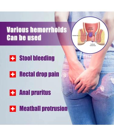 2pcs Hemorrhoid Spray Topical Hemorrhoid Relief Spray Relieve Swelling and Reduce Discomfort of Hemorrhoids Hemorrhoid Cure Liquid 30ml - Buy Online on GoSupps.com
