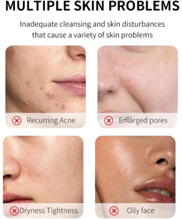 Green Tomato Clay Mask - Face Masks Skincare - Korean Face Mask - Clay Face Mask Facial kit - Face Masks Beauty with Green Mask Stick Clean Pore Gentle Nourish Face Care - Buy Online on GoSupps.com