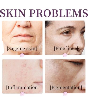 Retinol Serum for Face - Face Serum for Women - Anti-Aging & Anti-Wrinkle Serum - Hydrating Serum for Face - Serums Skincare - Moisturizing& Brightening - Buy Online on GoSupps.com
