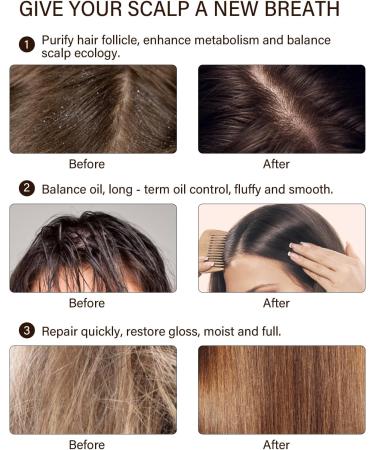  PHOGARY PHOGARY 2PCS Organic Ginger Hair Soap Shampoo Bar Natural Hair Care with Plant Extracts Moisturizes Hair and Cleanses Scalp Pores 3.88 oz - Buy Online on GoSupps.com