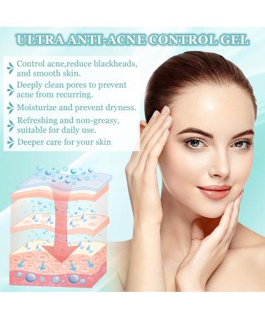 Henjunu Pimple cream antipimple gel acne cream gentle and nonirritating reduces blackheads and acne improves the appearance of the skin 20 g - Buy Online on GoSupps.com