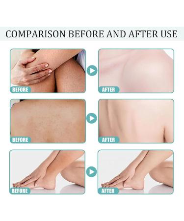 Buy Skin So Soft Original Bath Oil for Women - Nourishing Skin Bath Oil (1pcs) - International Shipping Available - Buy Online on GoSupps.com