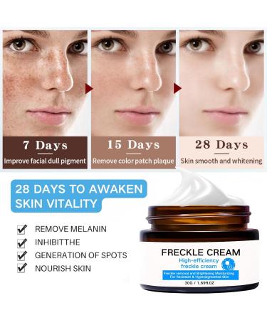 IZBEAUVO Dark Spot Remover for Face and Body Freckle Removal Cream Pigmentation Removal Cream Dark Spot Corrector Cream for Sun Spots Melasma Freckle Dark Spot Sun Spot Age Spot - Buy Online on GoSupps.com