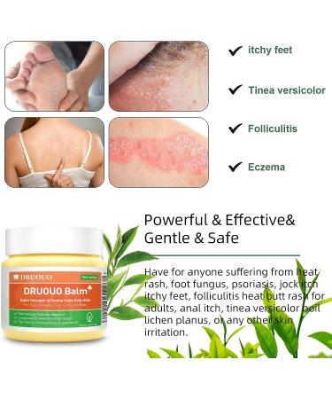 Draw Salve Eczema Cream for Athlete's Foot Relief | 8h Fast Acting Formula for Itchy Skin, Heat Rash, Tinea Versicolor, Lichen Planus, Cysts, Boils, and Ingrown Hairs - 2 Fl Oz - Buy Online on GoSupps.com
