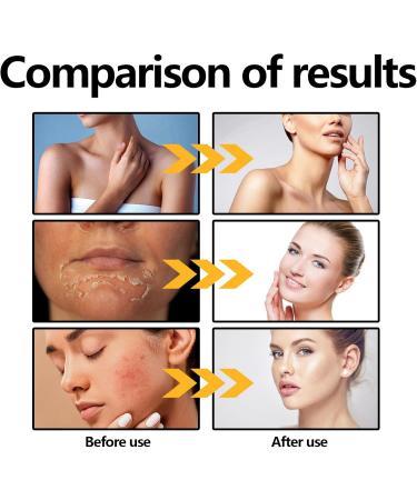 Centella Sunscreen SPF 50 PA++++ Madagascar Centella Sun Cream Water-Fit Sun Serum Sunscreen SPF 50 Face Moisturiser Hydrating Sunscreen UV Defense Refreshing Korean Sunscreen Sunscreen Oily Skin - Buy Online on GoSupps.com