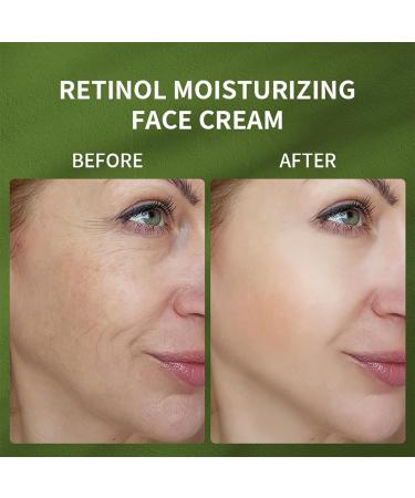 Moisturizing Retinol Face Cream - Anti-Wrinkle Hyaluronic Acid & Vitamins for Youthful Skin | Reduce Fine Lines & Dryness - Buy Online on GoSupps.com