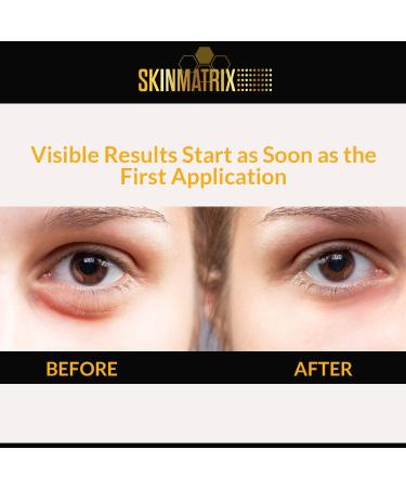 Puffy Eyes Treatment Serum with Hyaluronic Acid & Vitamin C - Anti Aging Under Eye Cream for Dark Circles, Fine Lines, Wrinkles & Bags - Instant Results - Buy Online on GoSupps.com