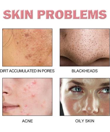 5 In 1 Cleansing Face Wash Foaming Cream Cleanser Water Based Cleanser Natural Foaming Cleaner Skin Care with Niacinamide Hyaluronic Acid Removes Excess Oil Unclogs Pores Reduces Blackheads - Buy Online on GoSupps.com