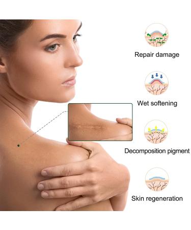 Silicone Scar Sheets - Medical Grade Removal Patches for C-Section, Surgery, Burn, Keloid, Acne - 1.6 x 60 - 1.5M - Buy Online on GoSupps.com