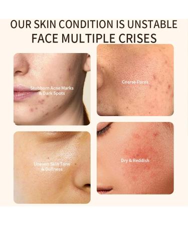 Dark Spot Correcting Glow Serum - Dark Spot Remover for Face - Nicotinamide Serum for Fade Acne Marks - Face Serum to Even Skin Tone & Shrink Pores - Face Moisturiser Skin Care for All Skin Types - Buy Online on GoSupps.com