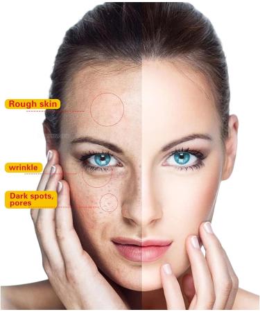 6 Bags of Soft Mask Powder-3 - Buy Online on GoSupps.com