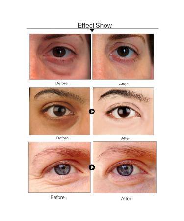 Buy Under Eye Patches for Dark Circles - Aloe Vera Hydrating Eye Gel Pads for Puffiness & Wrinkles - 30 Pairs for Firm Skin - Buy Online on GoSupps.com