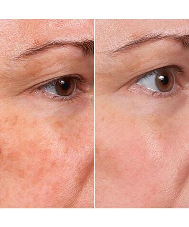 Rejuvenate Face Serum Face Serum Rejuvenate Skin Care Rejuvenate Resurfacing Face Serum Rejuvenation Anti Wrinkle and Remove Dark Spot Deeply Hydration(2pcs) - Buy Online on GoSupps.com