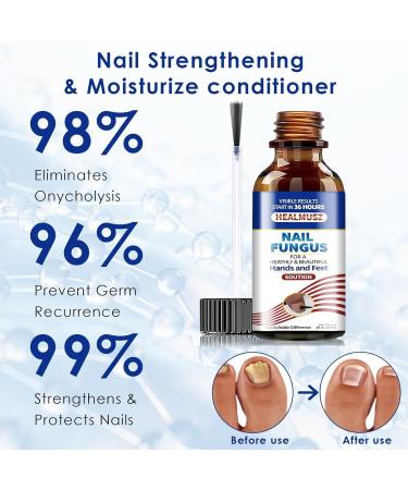 30ml Solution ongles Soins de la cuticule Huiles pour ongles incarn es Solution r parateurs ongles Renforcer l'ongle Restaurer l'aspect ongles Nutrir pour le peeling et le scrub du corps - Buy Online on GoSupps.com