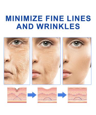 Buy Botox Stock Solution Facial Serum for Deep Wrinkles | Anti-Aging Collagen & Vitamin C Serum - Ship Worldwide - Buy Online on GoSupps.com
