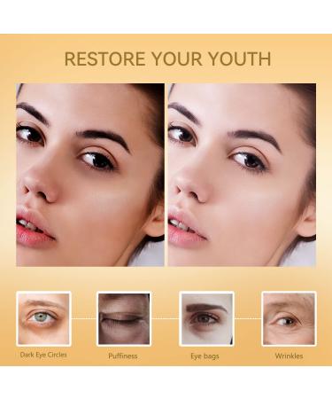 Xhoon Gold Collagen Under Eye Patches - Dark Circles & Puffiness Treatment - 20 Pairs - Buy Online on GoSupps.com