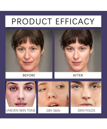 Bakuchiol Serum With Hyaluronic Acid And Peptide Retinol Alternative Face Serum For Face And Neck Korean Bakuchiol Concentrate Wrinkle Reduction Skin Firming (3) - Buy Online on GoSupps.com