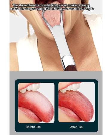 Mialle Metal Tongue Scraper - Effective Bad Breath Cleaner for Adults & Kids | Improve Oral Hygiene - Buy Online on GoSupps.com