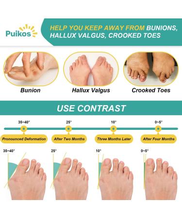 Puikos Bunion Corrector for Men & Women | Big Toe Splint & Hallux Valgus Relief | Adjustable Toe Straightener & Separator for Day/Night Use - Buy Online on GoSupps.com