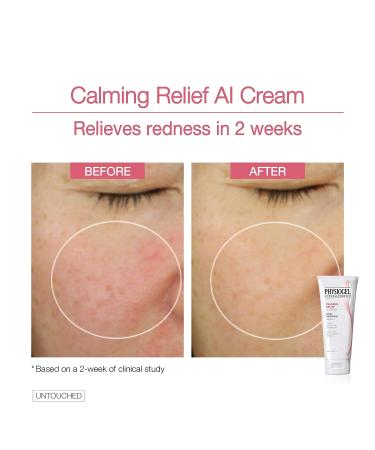 Physiogel Calming Relief A.I. Face Cream - Soothing Eczema Cream for Sensitive Skin - Buy Online on GoSupps.com