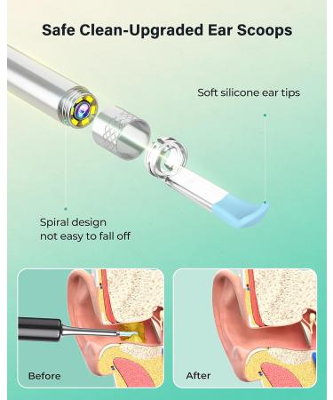 BEWBIRD Ear Wax Removal Kit with Wireless Camera - 1080P FHD Earwax Remover Tool for iPhone, iPad, Android - Silver-grey - Buy Online on GoSupps.com