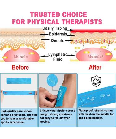 ATETEO Kinesiology Tape E - Pink Large 5m x 5cm - Buy Online on GoSupps.com