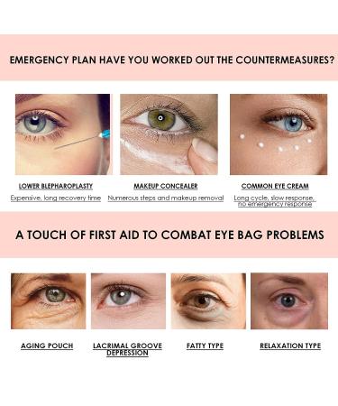 FIEFROTD CHAFFEELIFE Snake Venom Peptide Anti-Wrinkle Eye Cream - 2pcs Set for Removing Eye Bags, Dark Circles, and Wrinkles - Buy Online on GoSupps.com