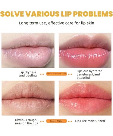 Honey Lip Butter Propolis Lip Cerin Honey Bee Lip Butter Lip Balm Stick Scented Lip Balm Hydrating Overnight Lip Balm & Mask Lipstick Deeply Nourishes and Softens Lip Lip Moisturizer Honey Lip Balm - Buy Online on GoSupps.com