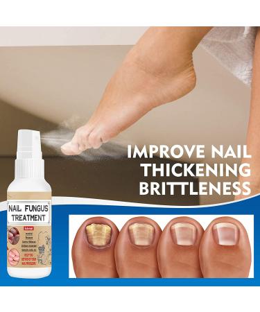 Effective Toenail Fungus Treatment - Restore Healthy Nail Appearance - Buy Online on GoSupps.com